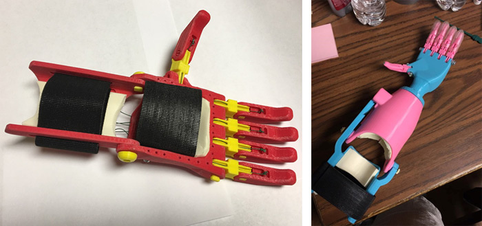 3d printed hand for kids born without one