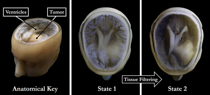 3d-printed-brain