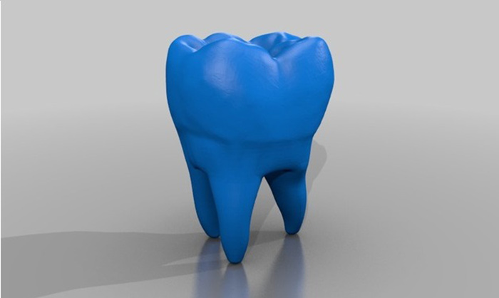 dental-3d-priniting